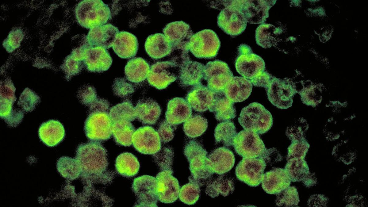 Kerala’s Kasaragod reports fresh amoebic brain infection case; 18-year-old in critical condition
